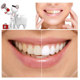 Activated Charcoal Teeth Whitener